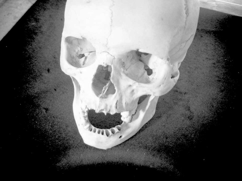 Free Resource: The Skeleton&nbsp;Game