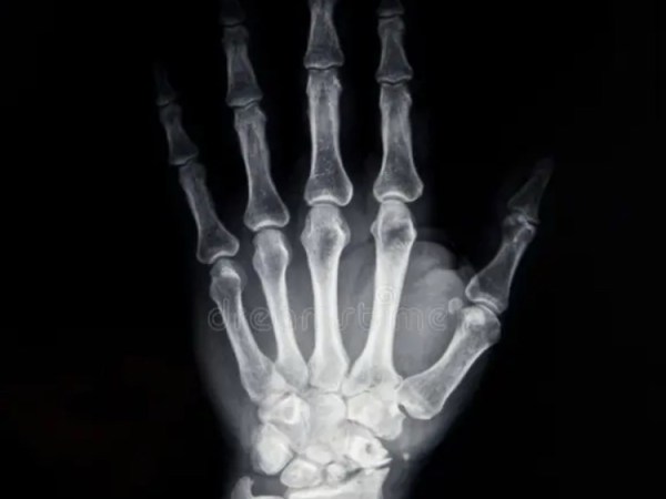 Embodiment (and how to use&nbsp;it)